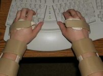 www.tendonitisexpert.com_images_ergonomic_keyboard_typing_with_wristbraces_picture.jpg